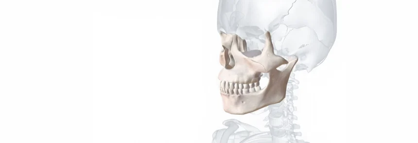 การผ่าตัดเลื่อนกระดูกขากรรไกรบนและล่างมาทางด้านหน้า (Maxillomandibular Advancement Surgery หรือ MMA)