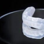 นอนกัดฟัน แก้ด้วย Splint