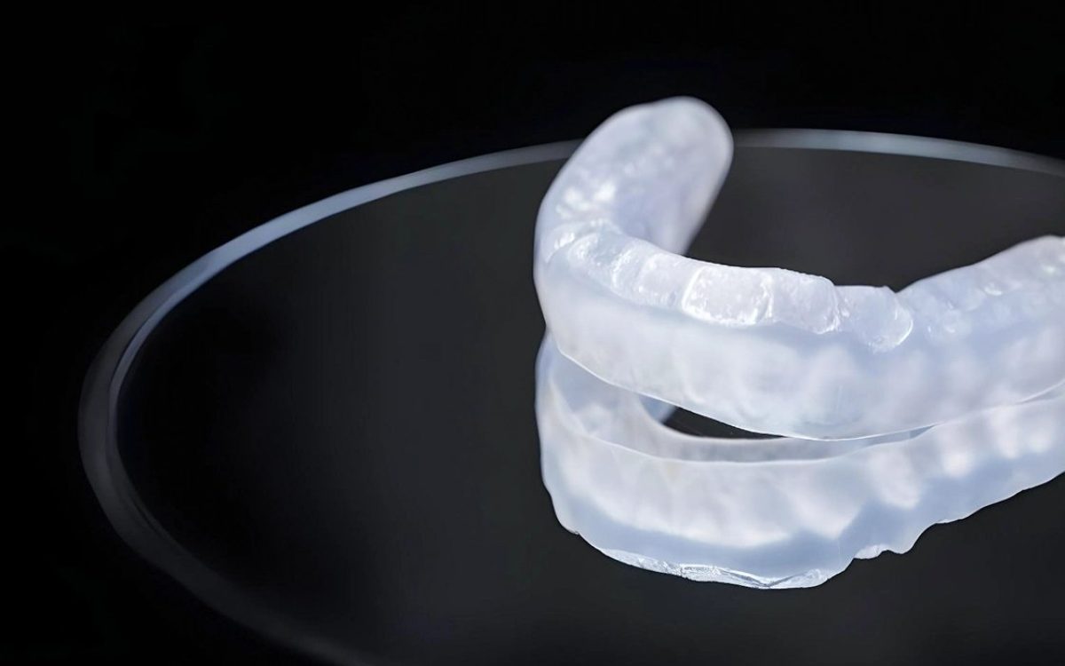 teeth grinding while sleeping, here’s how to fix it นอนกัดฟัน แก้ด้วย Splint
