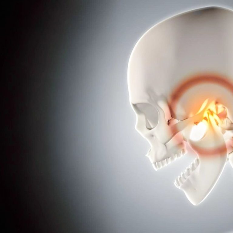 ข้อต่อขากรรไกรอักเสบ